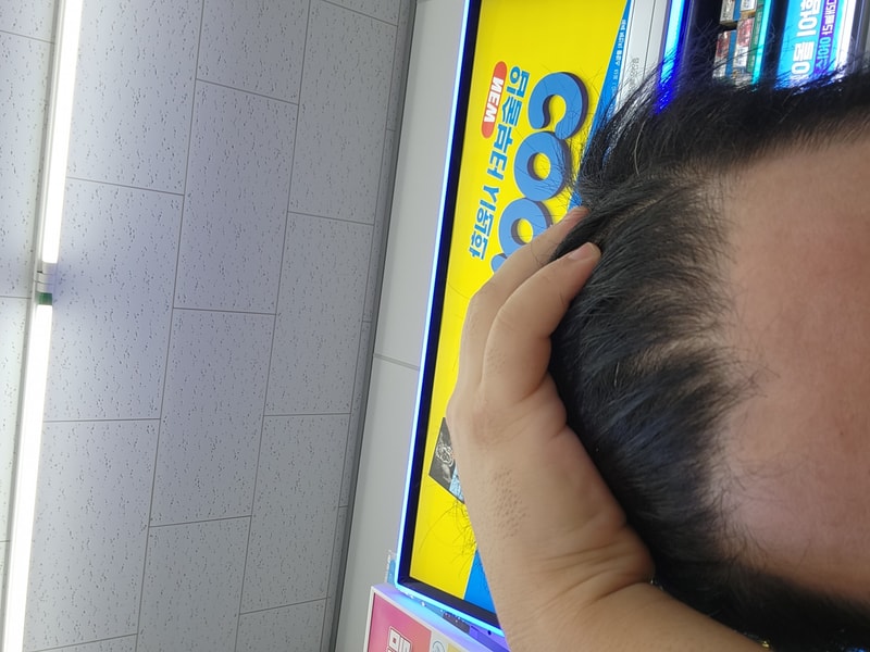 M자 초기인가요?