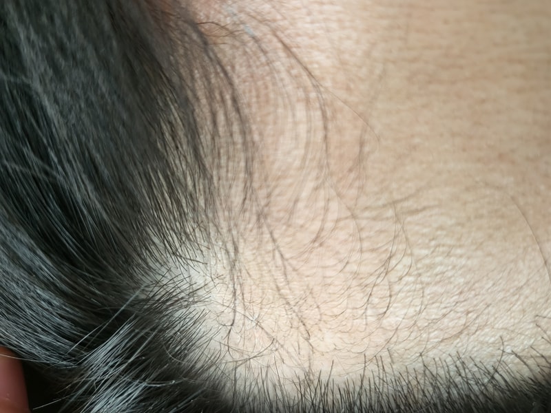 1000010499.jpg