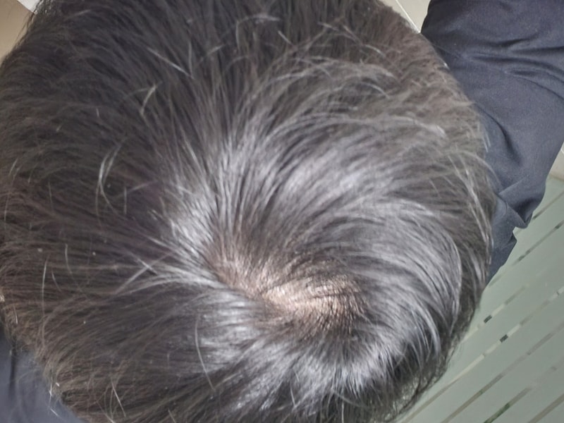 20220308_104425.jpg