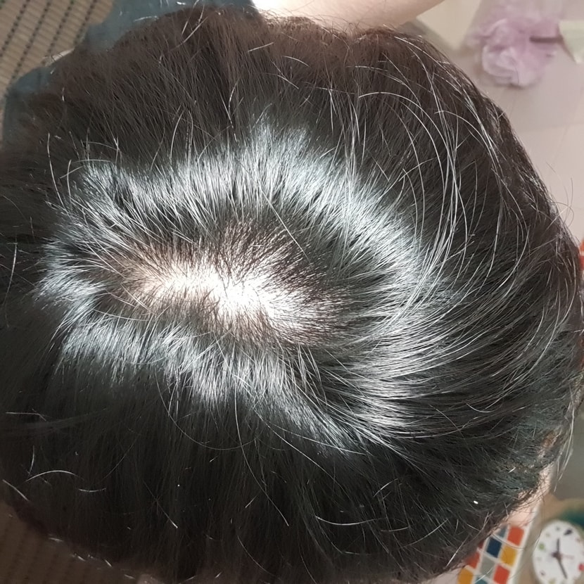 머리 감기 전