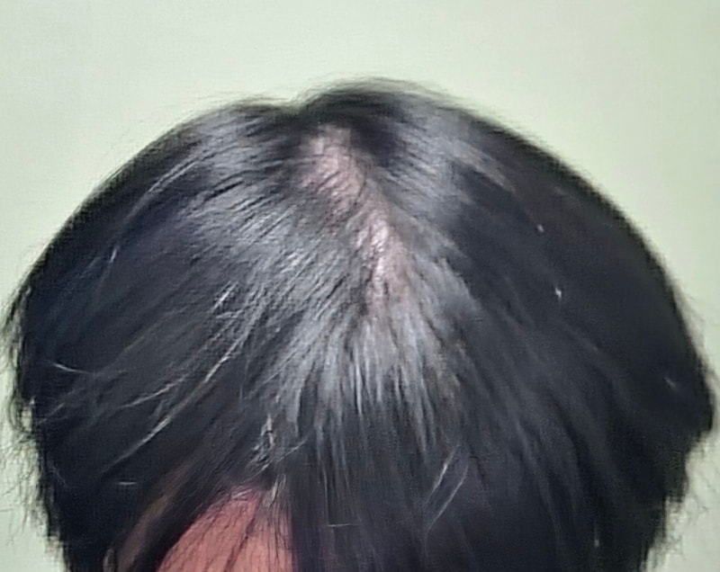 1000011964.jpg