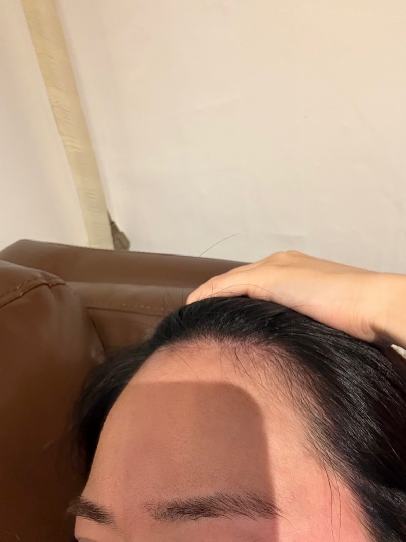 탈모일까요?