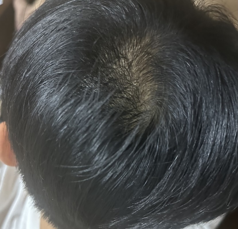 빛 덜 비쳤을 때입니다