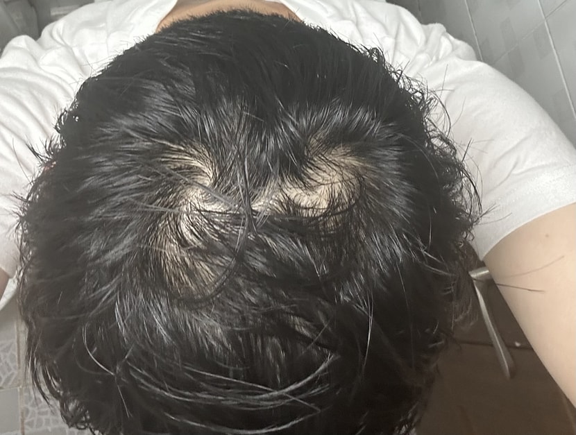머리 감고나서 입니다