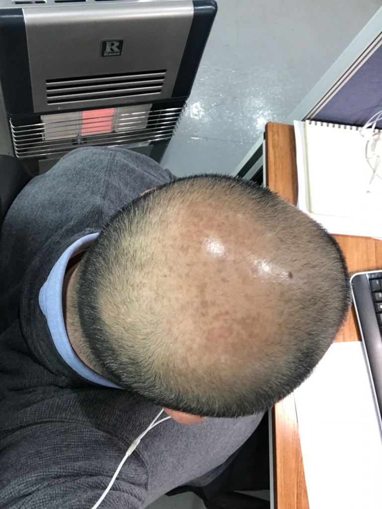 KakaoTalk_20180313_123831416.jpg