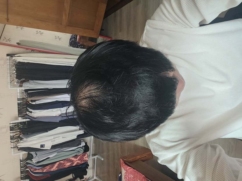 약복용 2주차