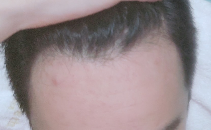 후