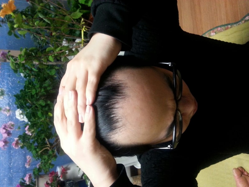 탈모4 20170316_183909.jpg