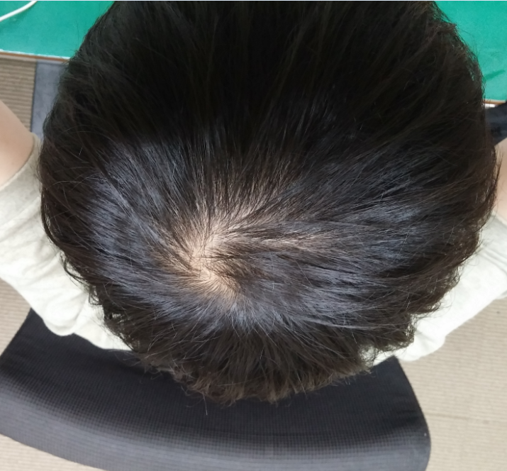 20140821.PNG