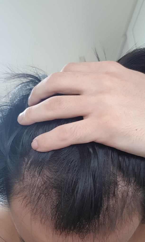 복용 전