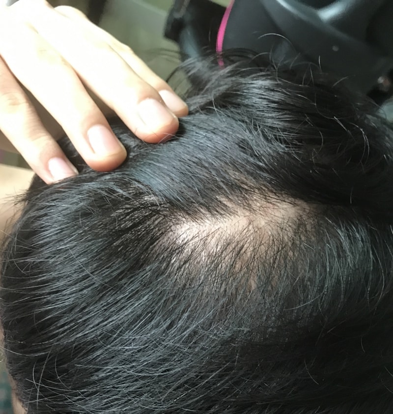KakaoTalk_20170821_172620998.jpg