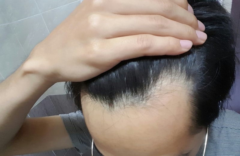 20180105_223419.jpg