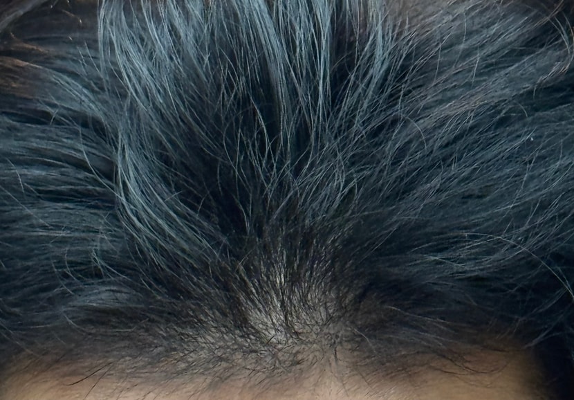 현재