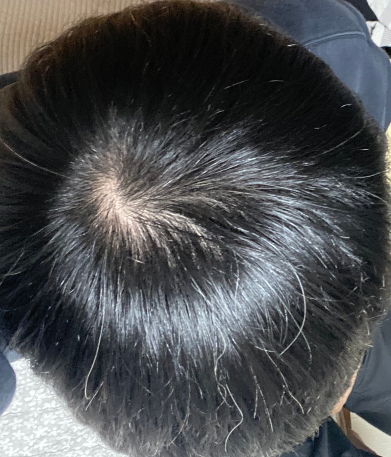 형님들 판단좀 해주세요..