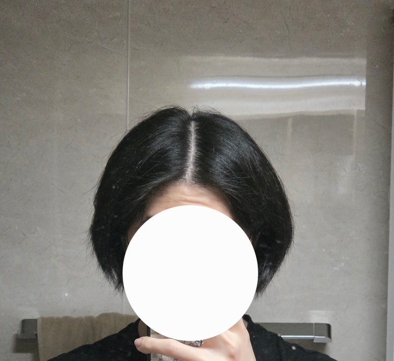 혹시 이소티논이랑 탈모약 같이드시는분계신가요?