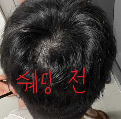 쉐딩 전.png