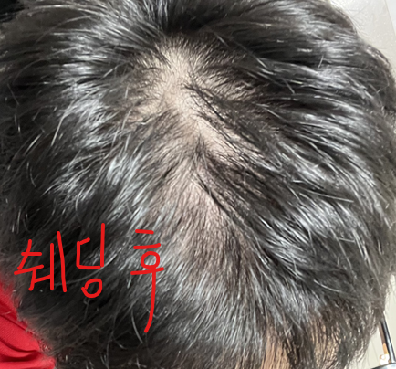 쉐딩 후.png
