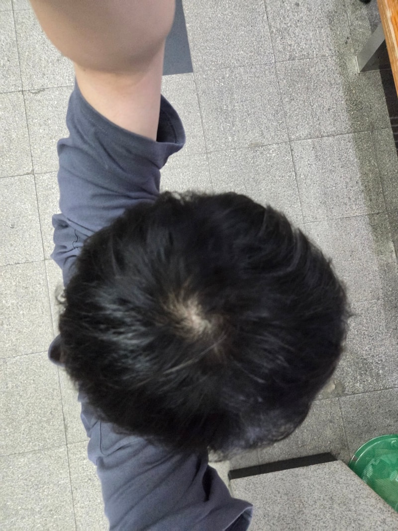 정수리 1.jpg