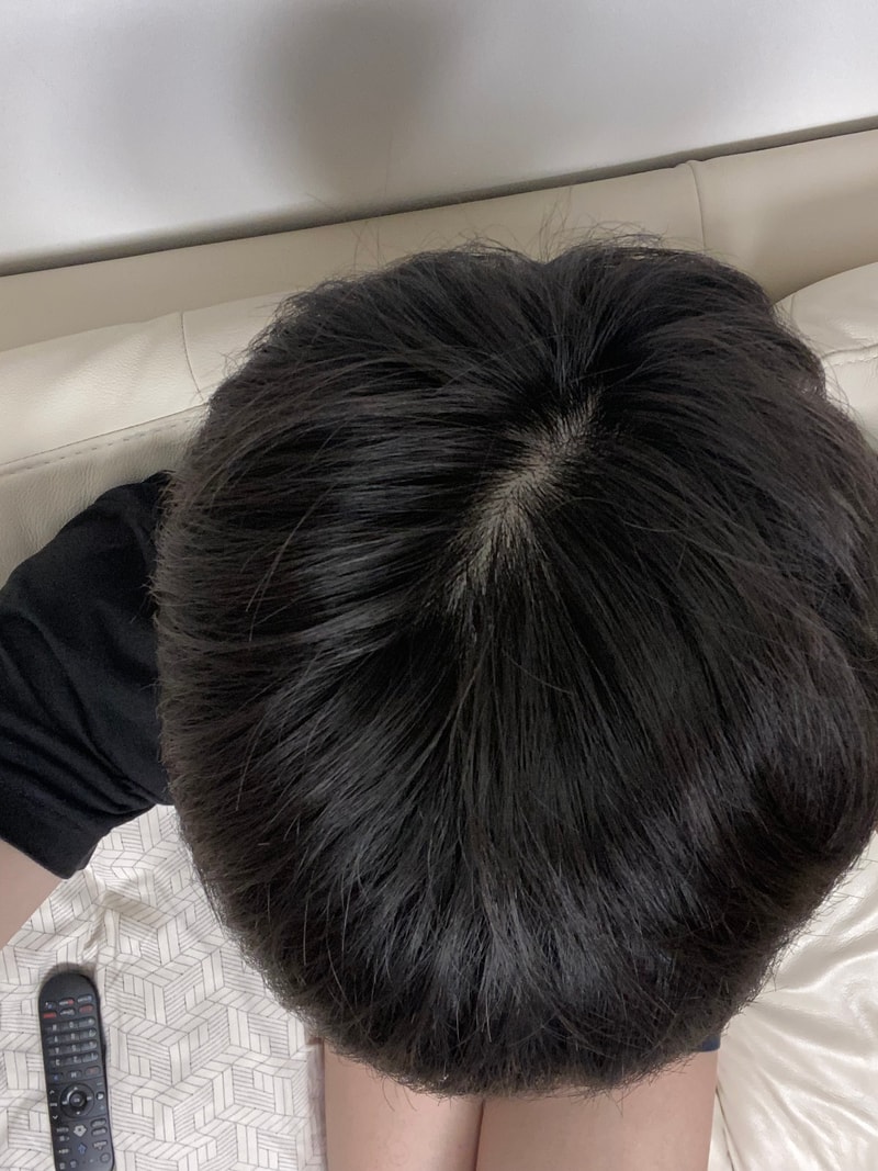 정수리 위험한가요?