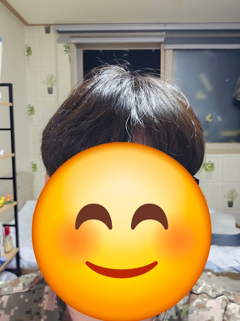 자연스러운 가르마인건지 탈모인지 궁금합니다..