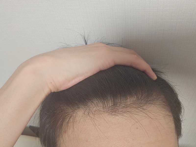 m자 심한가요