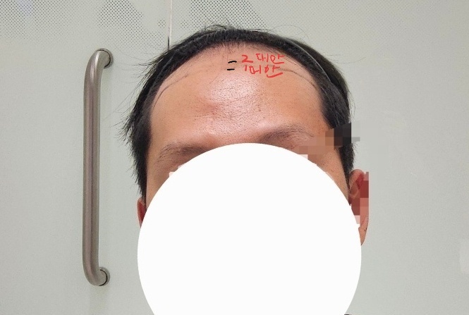 이식 견적 받아왔습니다. 조언좀 부탁드립니다