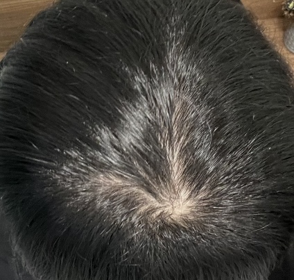 A 27-year-old man who takes three years of Pina