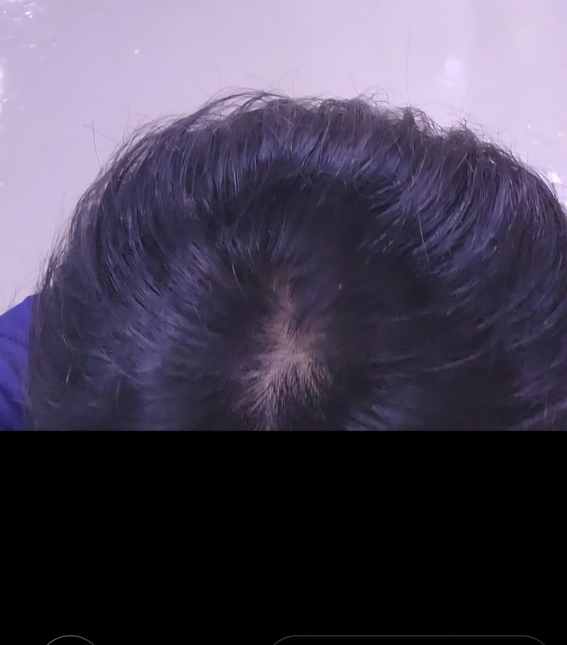 Do I look like I'm losing a lot of hair???