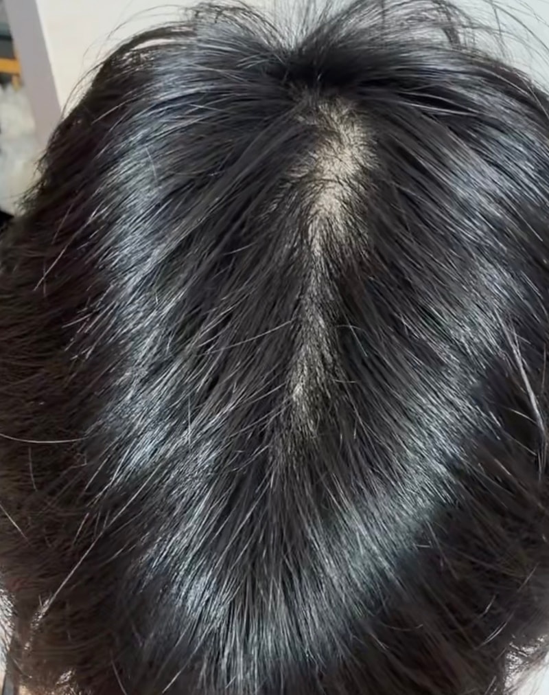 薄毛ですか？
