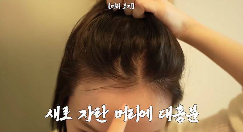 탈모 약 없이 극복한 간증템