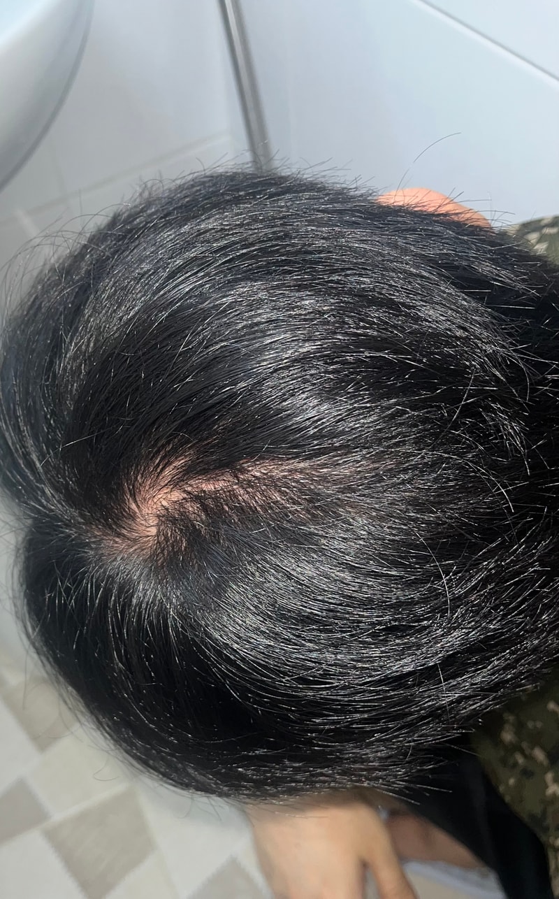 둿머리 갈라짐 미치겠네요