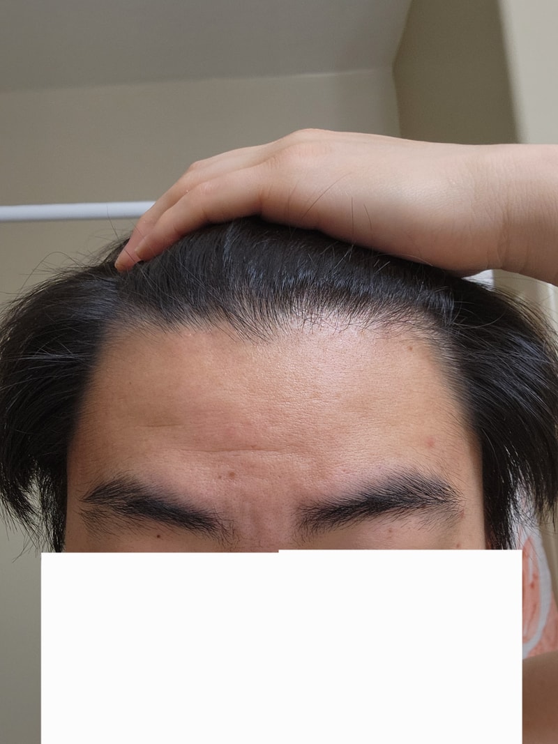 앞머리.jpg