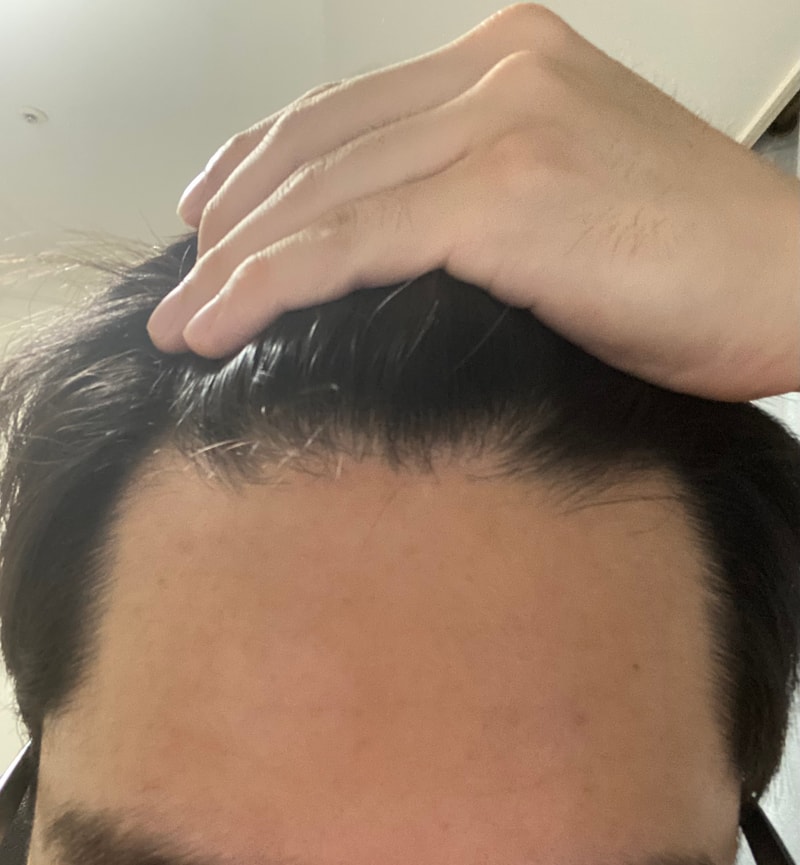 탈모인지 확인 부탁드려요 