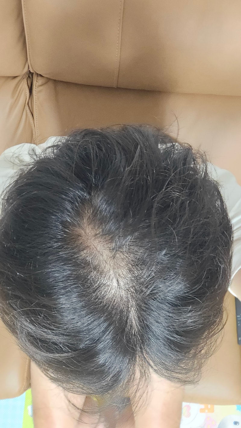 40대 후반되니 머리카락에 힘이 없네요