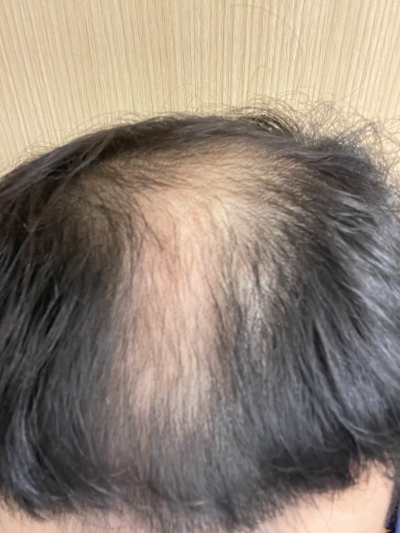 자라다의원 상담 다녀왔습니다.