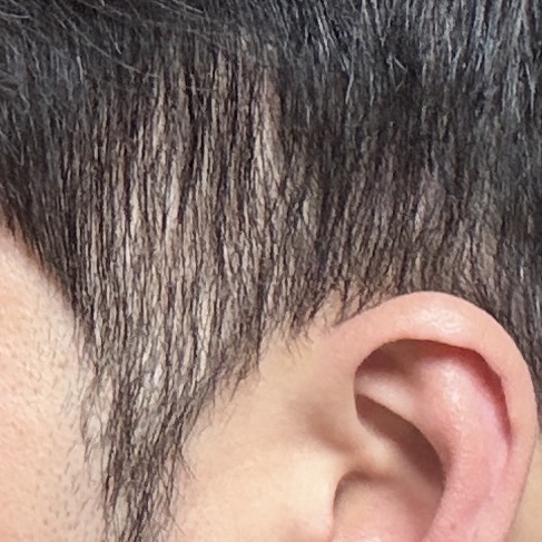 탈모인건지 모발끊어짐인지 봐주세요 