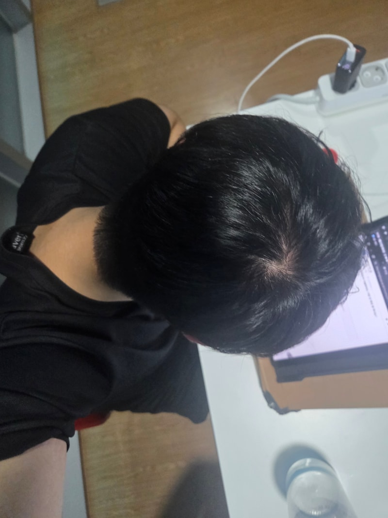미녹정 1달차인데 원래 이런가요??