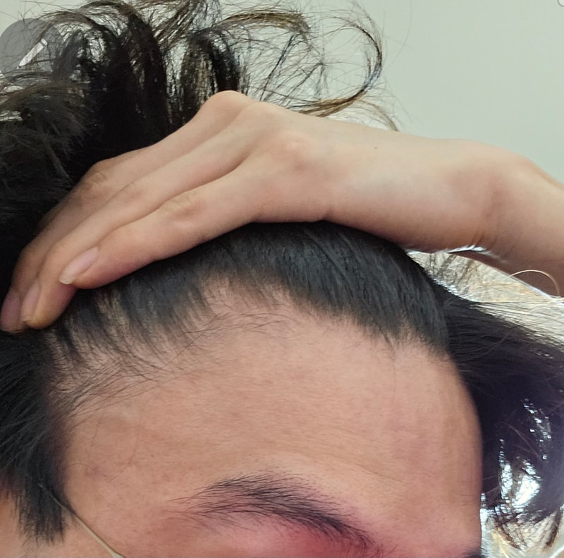 피나 먹고 있는데 두타로 바꿔야할까요?