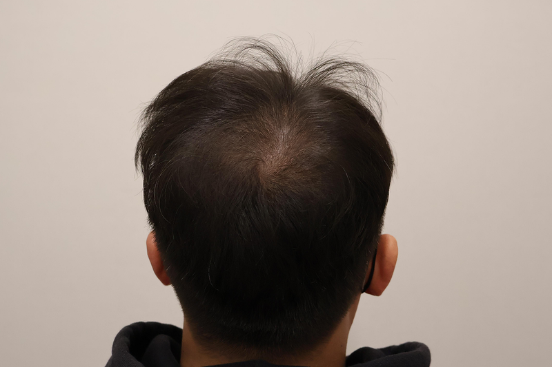 지금 제 상태 어떤가요?