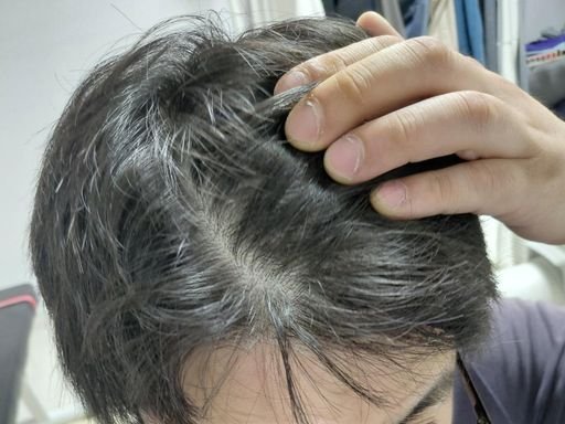 선배님들 사진 보시고 판단 부탁드리겠습니다!!!(투표있습니다)