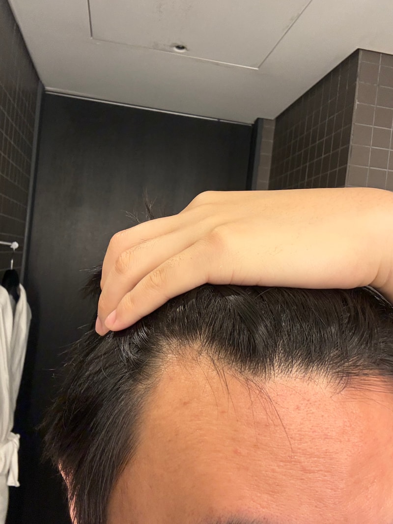 이정도면 얼마나 심한건가요?? 