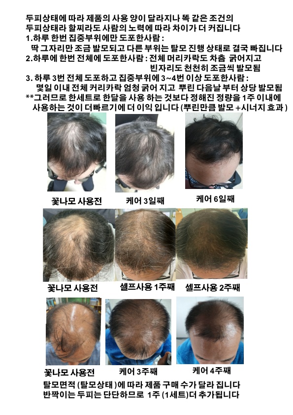임상실험 및 인체체험 결과 모발이식보다 더 빠르고 더 완벽한 정상수명 그이상을 가지는 진짜 제품을 소개 하려 합니다 