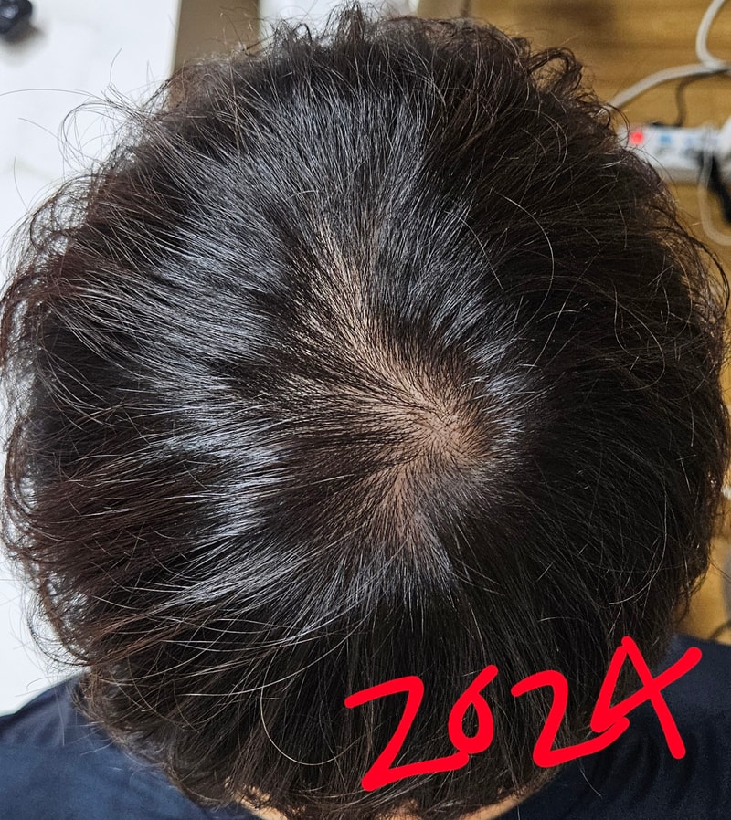 1000044046.jpg