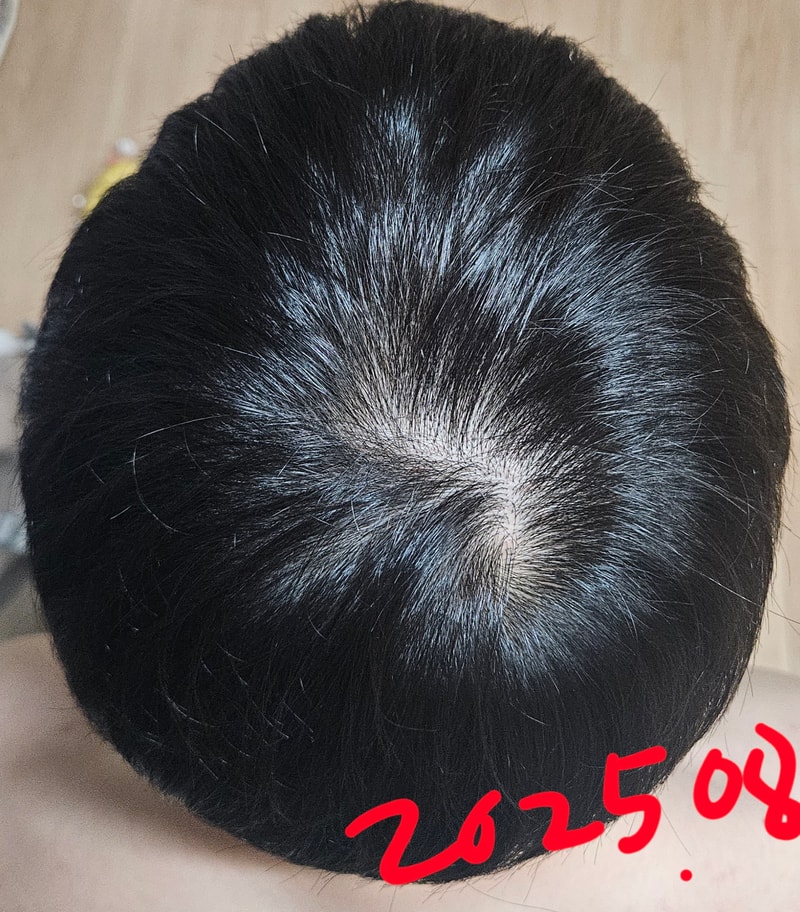 1000025853.jpg