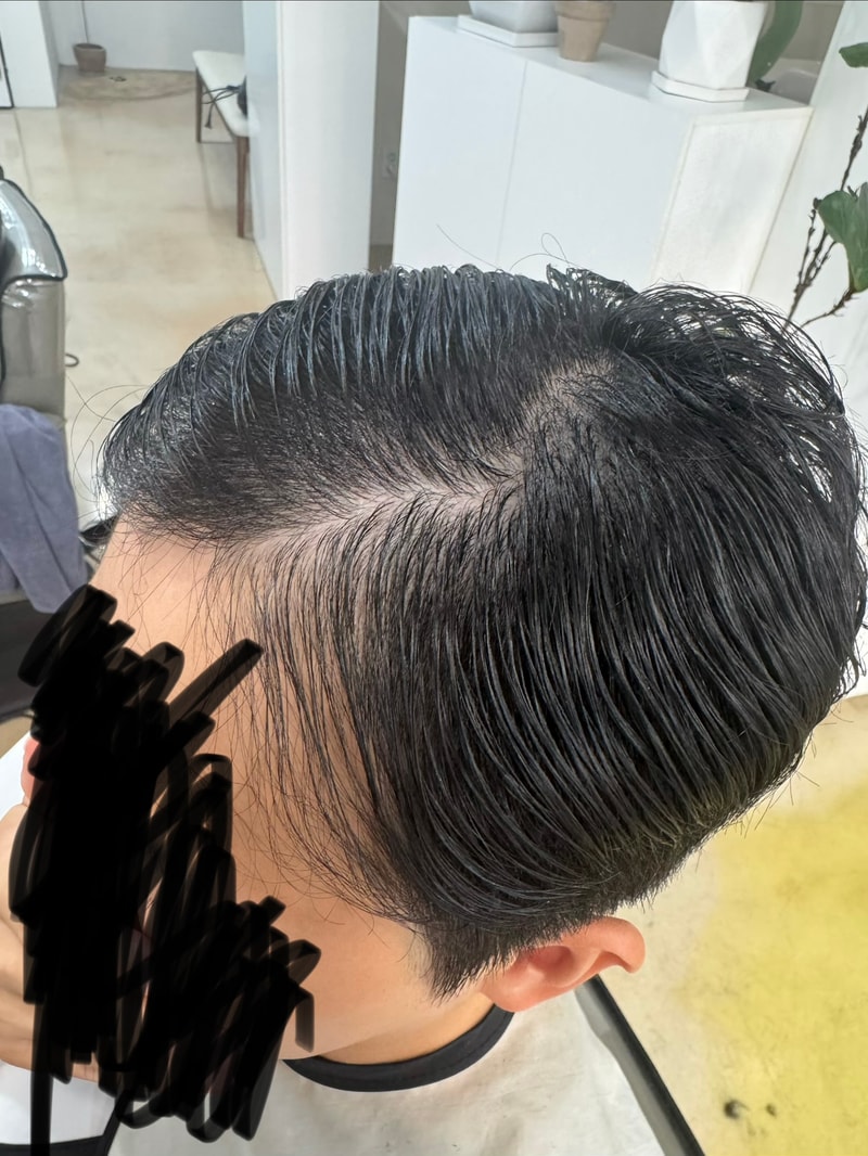 탈모인가요..? (사진 첨부)