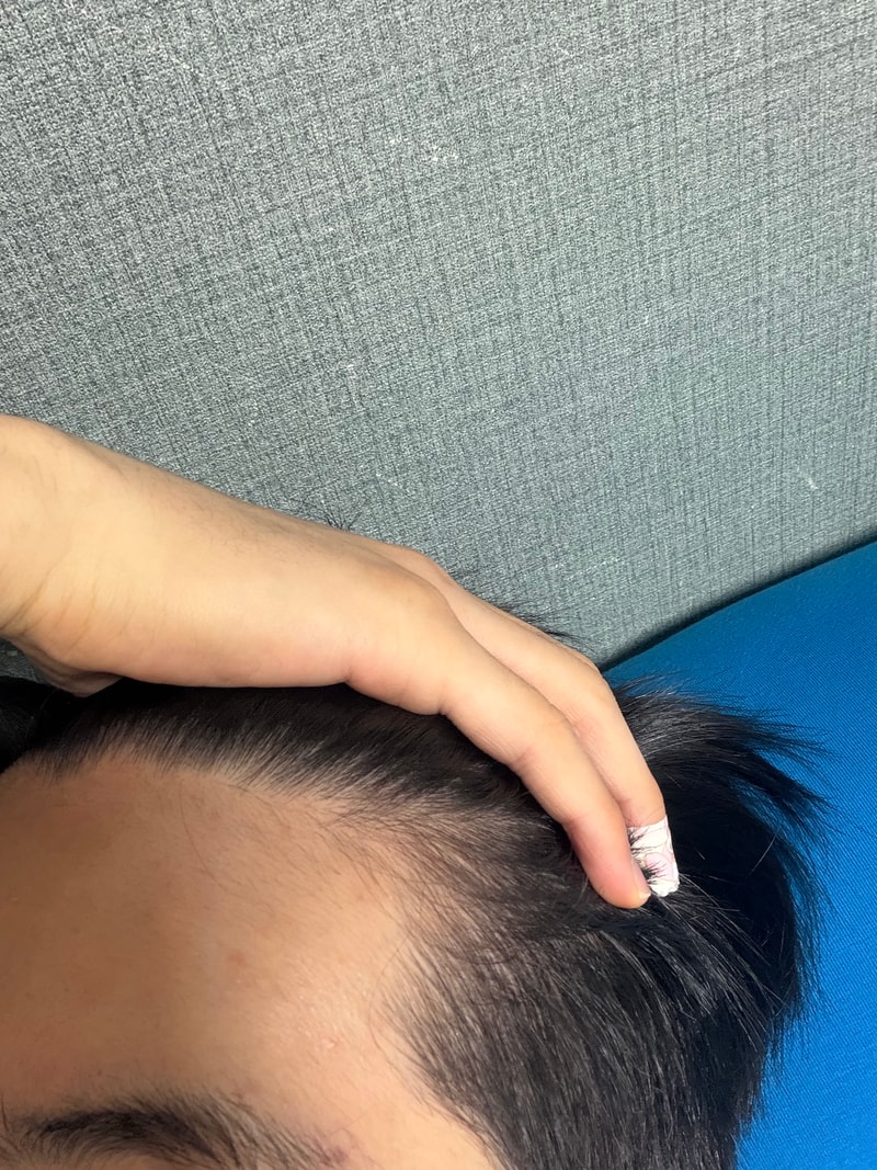 탈모입니까 형님들ㅜ