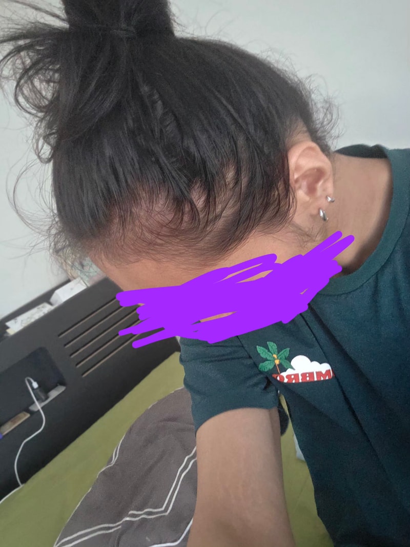 M 자가 한쪽만 심한거 같은데..