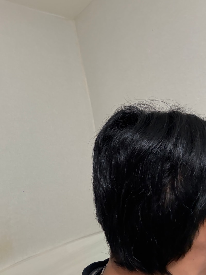 채취부위 땜빵처럼 남은거 같은데 이거 맞나요