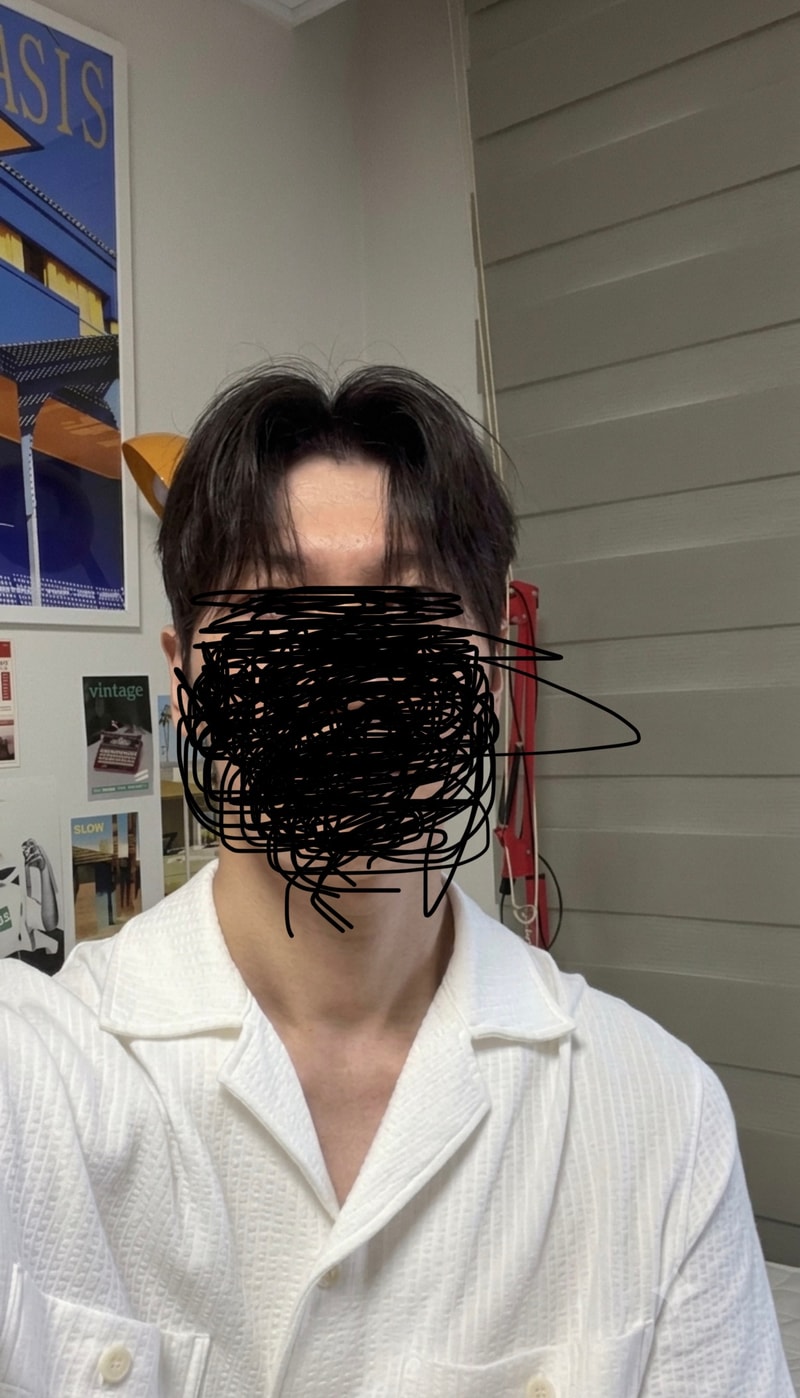 벌써 탈모약 복용한지 13년차네요 