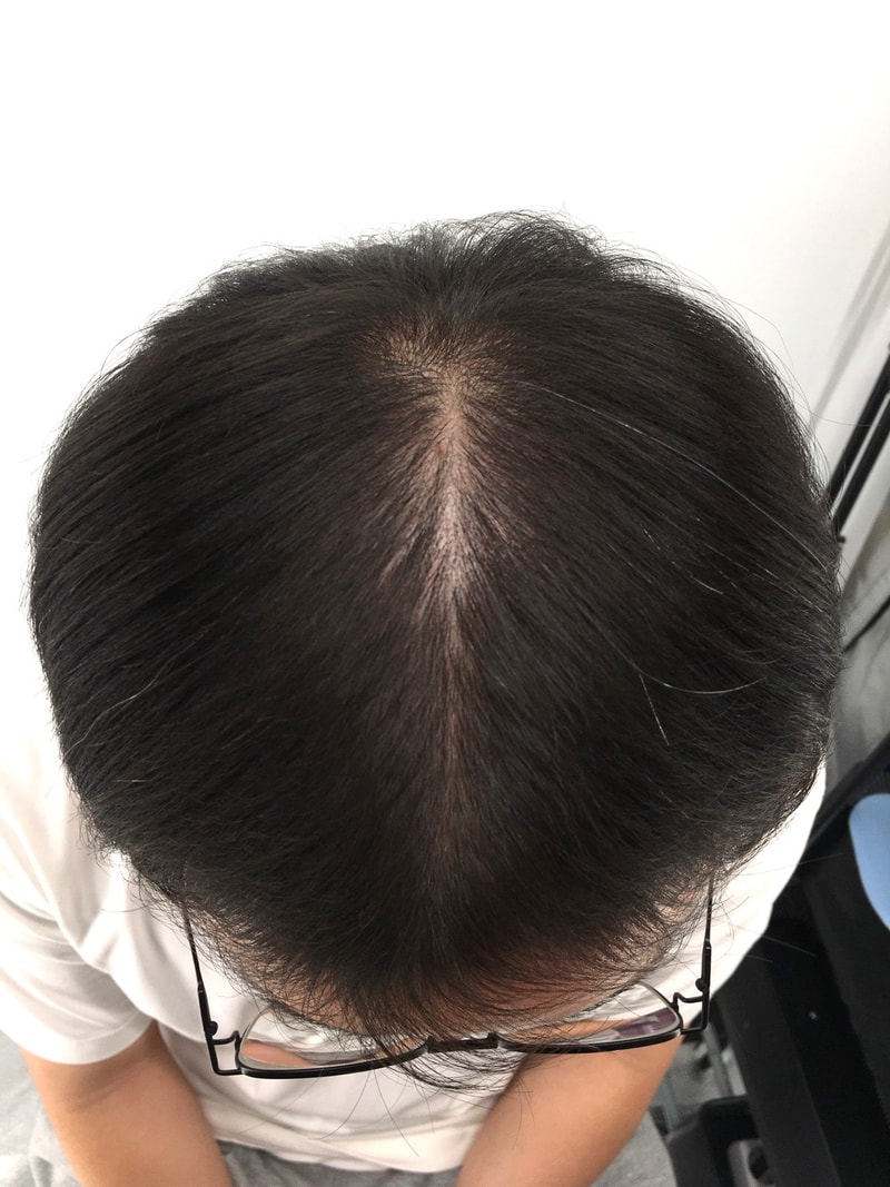 주사치료 경과